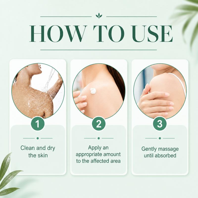 South Moon Vitiligo Care Cream – 30 g