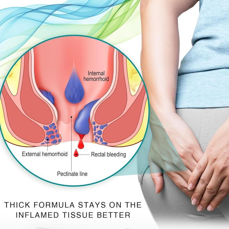 GAOD Hemorrhoid Cream
