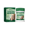 South Moon Vitiligo Care Cream – 30 g